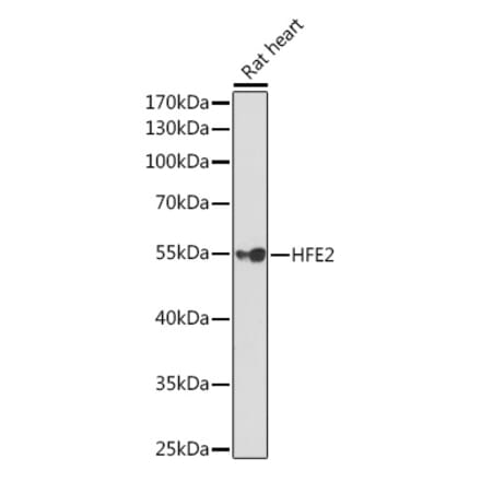 Western Blot - Anti-Hemojuvelin Antibody (A14690) - Antibodies.com