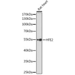 Western Blot - Anti-Hemojuvelin Antibody (A14690) - Antibodies.com