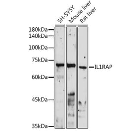 Western Blot - Anti-IL-1RAcP Antibody (A14691) - Antibodies.com
