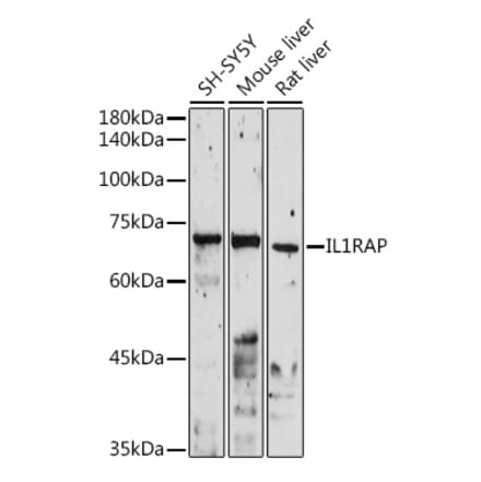 Western Blot - Anti-IL-1RAcP Antibody (A14691) - Antibodies.com