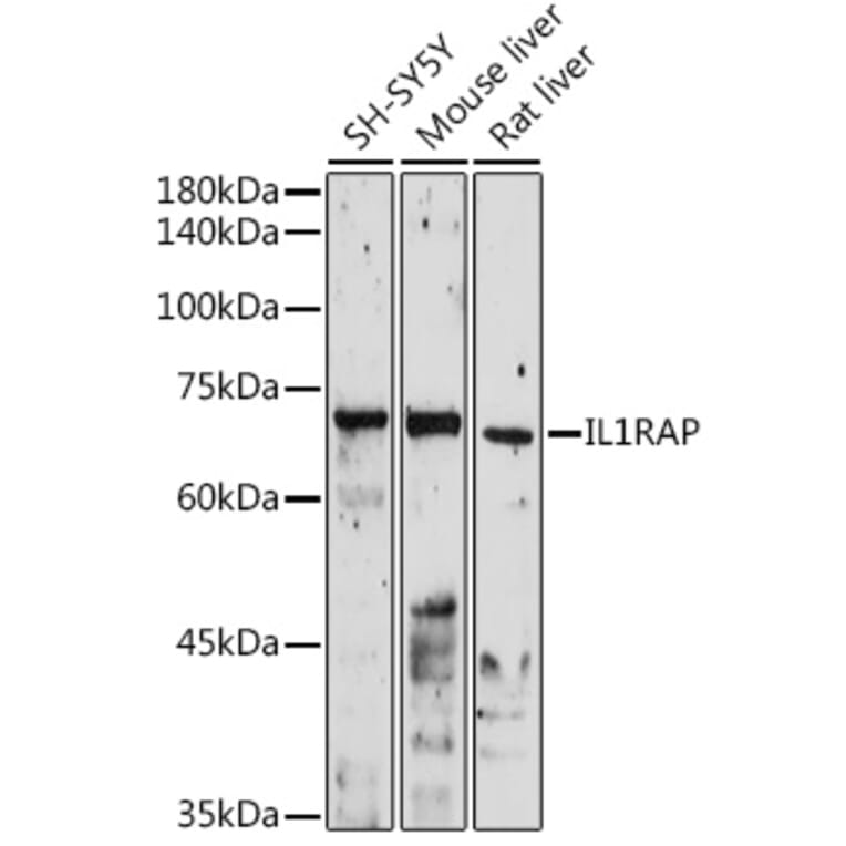 Western Blot - Anti-IL-1RAcP Antibody (A14691) - Antibodies.com