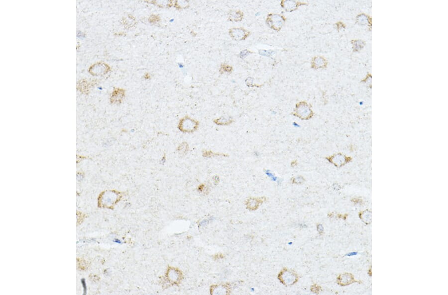 Immunohistochemistry - Anti-IL-1RAcP Antibody (A14691) - Antibodies.com