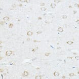 Immunohistochemistry - Anti-IL-1RAcP Antibody (A14691) - Antibodies.com