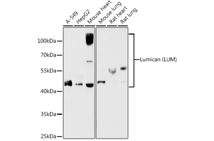 Western Blot - Anti-Lumican Antibody (A14693) - Antibodies.com