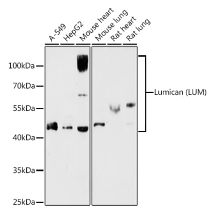 Western Blot - Anti-Lumican Antibody (A14693) - Antibodies.com