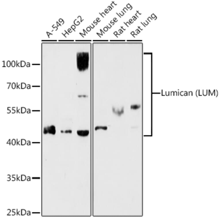 Western Blot - Anti-Lumican Antibody (A14693) - Antibodies.com