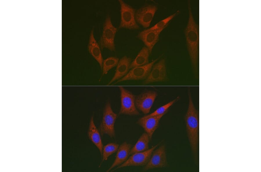 Immunofluorescence - Anti-Lumican Antibody (A14693) - Antibodies.com