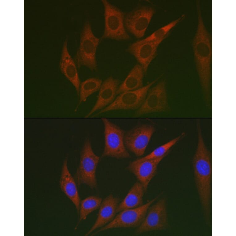 Immunofluorescence - Anti-Lumican Antibody (A14693) - Antibodies.com