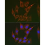 Immunofluorescence - Anti-Lumican Antibody (A14693) - Antibodies.com