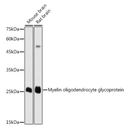 Western Blot - Anti-Myelin oligodendrocyte glycoprotein Antibody (A14694) - Antibodies.com