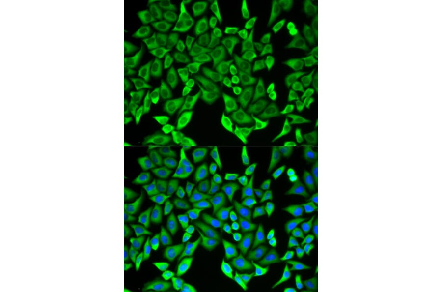 AntiMOG Antibody (A14694)