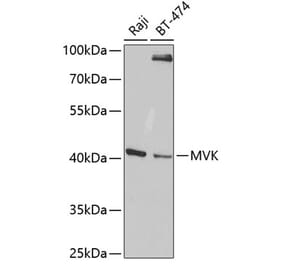 Western Blot - Anti-MVK Antibody (A14695) - Antibodies.com