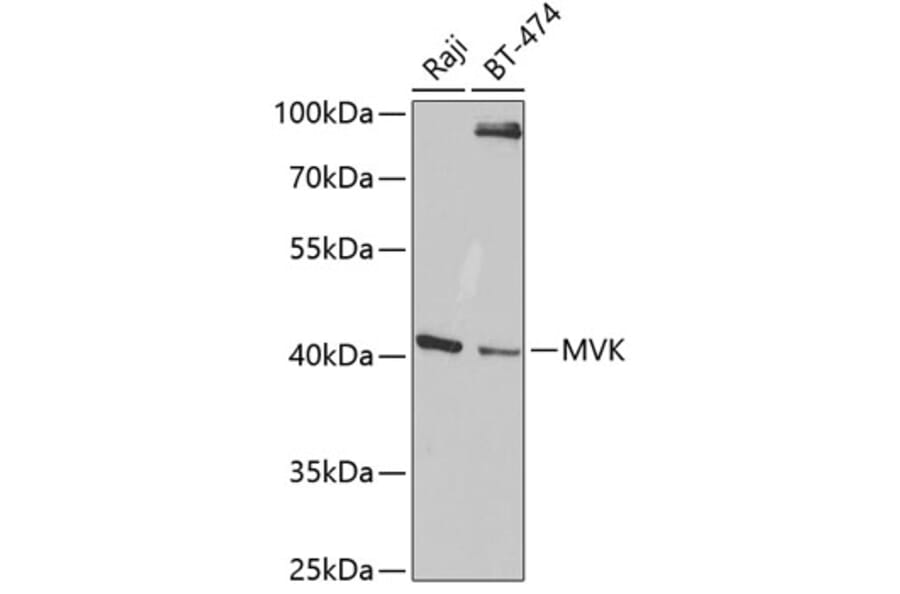 Western Blot - Anti-MVK Antibody (A14695) - Antibodies.com