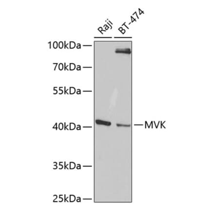 Western Blot - Anti-MVK Antibody (A14695) - Antibodies.com