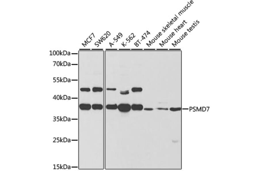 Western Blot - Anti-PSMD7/Mov34 Antibody (A14696) - Antibodies.com
