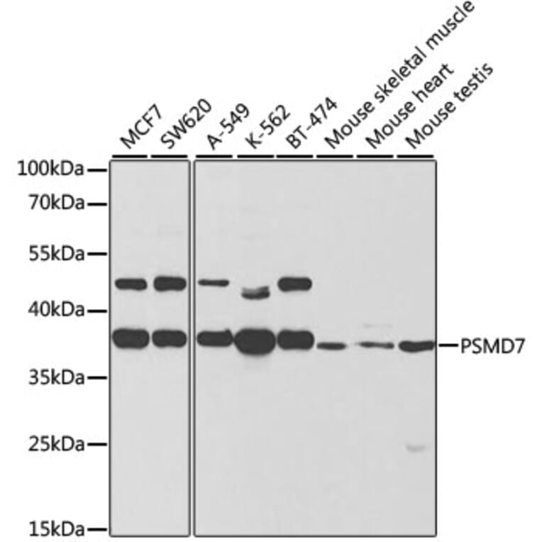 Western Blot - Anti-PSMD7/Mov34 Antibody (A14696) - Antibodies.com