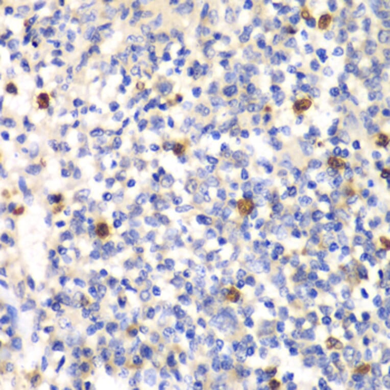 Immunohistochemistry - Anti-PSMD7/Mov34 Antibody (A14696) - Antibodies.com