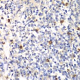 Immunohistochemistry - Anti-PSMD7/Mov34 Antibody (A14696) - Antibodies.com