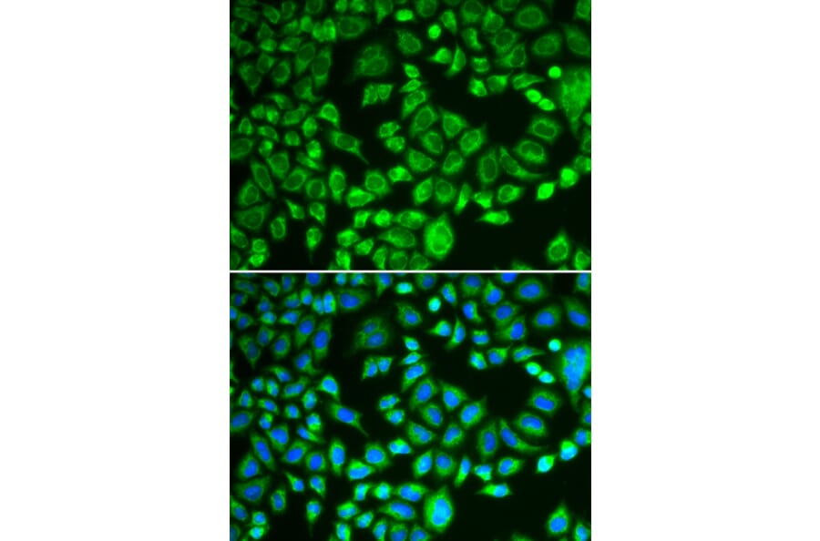 Immunofluorescence - Anti-PSMD7/Mov34 Antibody (A14696) - Antibodies.com