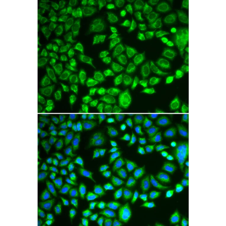Immunofluorescence - Anti-PSMD7/Mov34 Antibody (A14696) - Antibodies.com