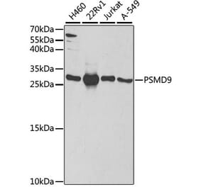 Western Blot - Anti-PSMD9 Antibody (A14697) - Antibodies.com