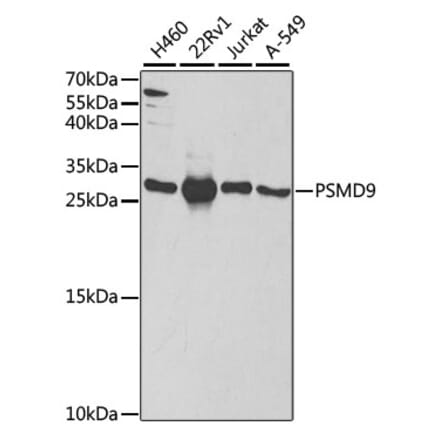 Western Blot - Anti-PSMD9 Antibody (A14697) - Antibodies.com