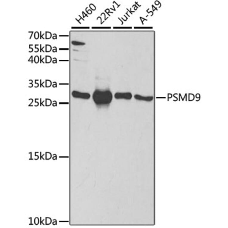 Western Blot - Anti-PSMD9 Antibody (A14697) - Antibodies.com
