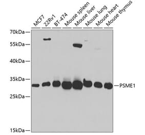 Western Blot - Anti-PSME1 Antibody (A14698) - Antibodies.com