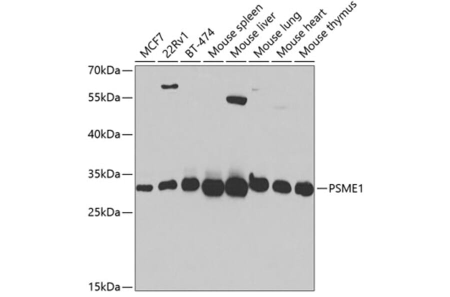 Western Blot - Anti-PSME1 Antibody (A14698) - Antibodies.com