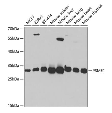 Western Blot - Anti-PSME1 Antibody (A14698) - Antibodies.com