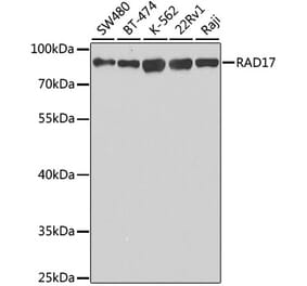 Western Blot - Anti-Rad17 Antibody (A14699) - Antibodies.com