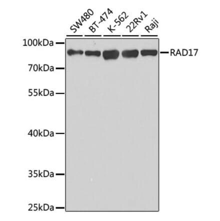 Western Blot - Anti-Rad17 Antibody (A14699) - Antibodies.com