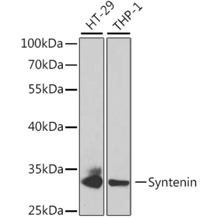 Western Blot - Anti-Syntenin Antibody (A14700) - Antibodies.com