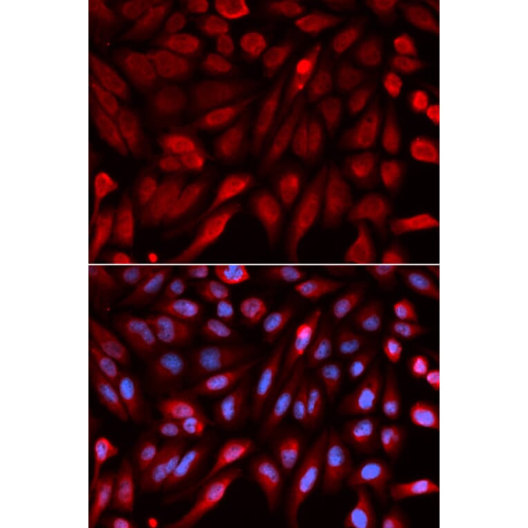 Immunofluorescence - Anti-Syntenin Antibody (A14700) - Antibodies.com