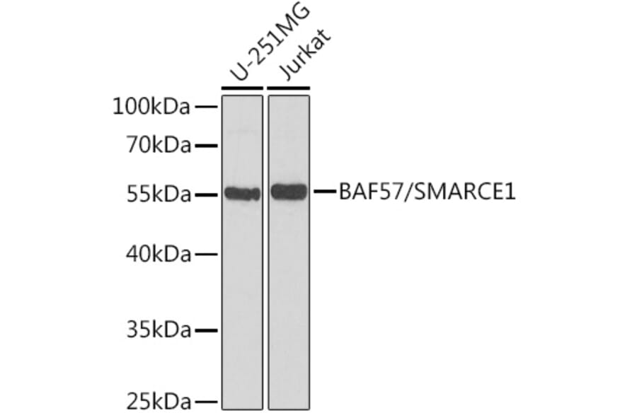 Western Blot - Anti-BAF57 / SMARCE1 Antibody (A14701) - Antibodies.com