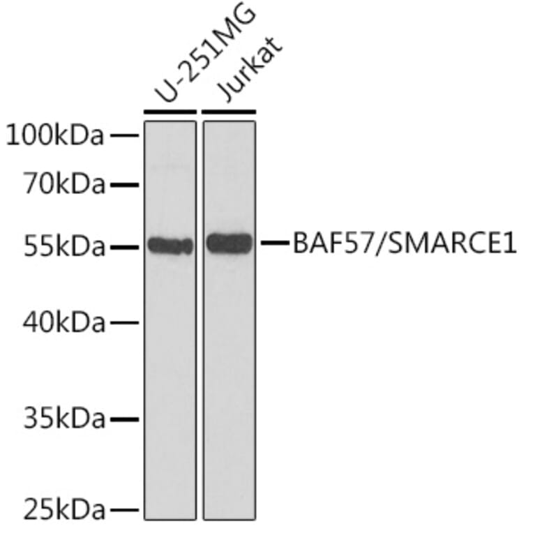 Western Blot - Anti-BAF57 / SMARCE1 Antibody (A14701) - Antibodies.com