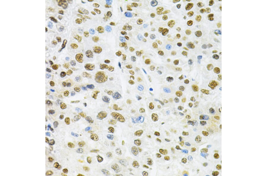 Immunohistochemistry - Anti-BAF57 / SMARCE1 Antibody (A14701) - Antibodies.com