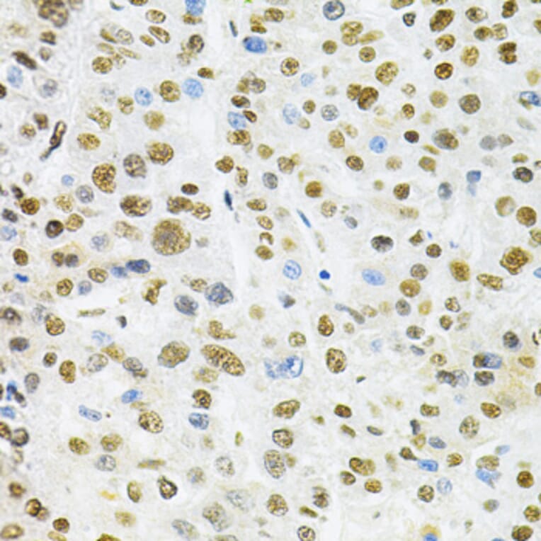 Immunohistochemistry - Anti-BAF57 / SMARCE1 Antibody (A14701) - Antibodies.com