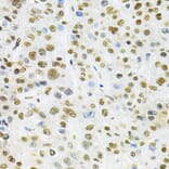 Immunohistochemistry - Anti-BAF57 / SMARCE1 Antibody (A14701) - Antibodies.com