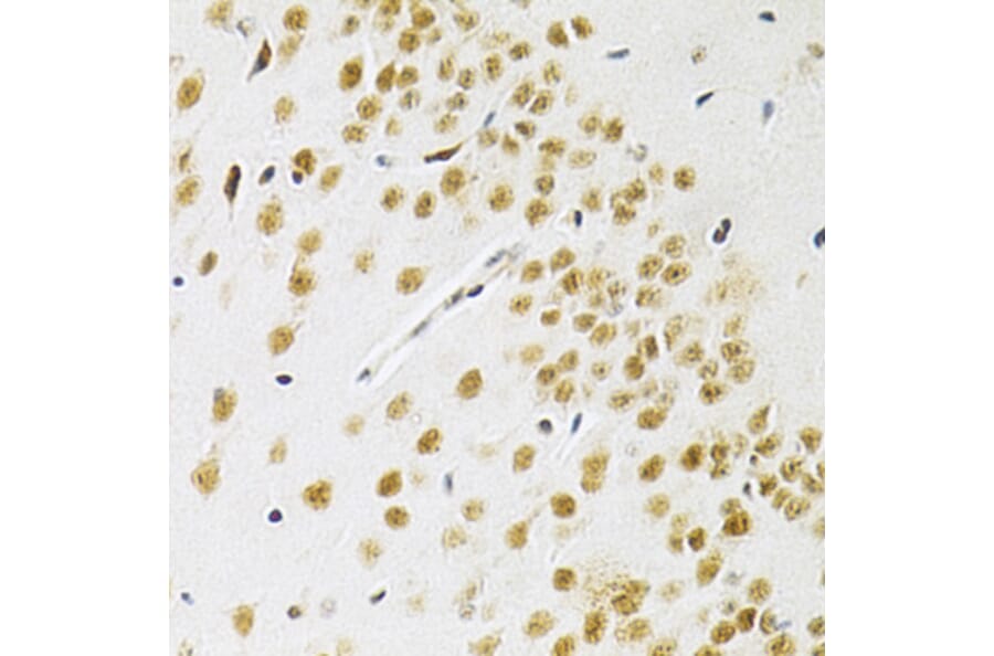Immunohistochemistry - Anti-BAF57 / SMARCE1 Antibody (A14701) - Antibodies.com