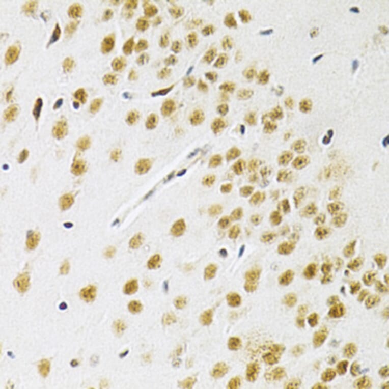 Immunohistochemistry - Anti-BAF57 / SMARCE1 Antibody (A14701) - Antibodies.com