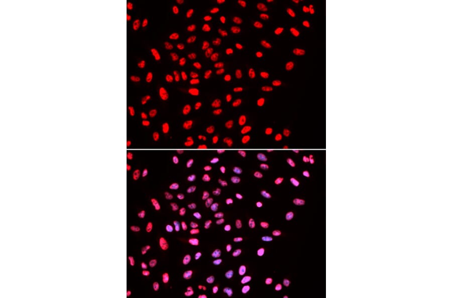 Immunofluorescence - Anti-BAF57 / SMARCE1 Antibody (A14701) - Antibodies.com