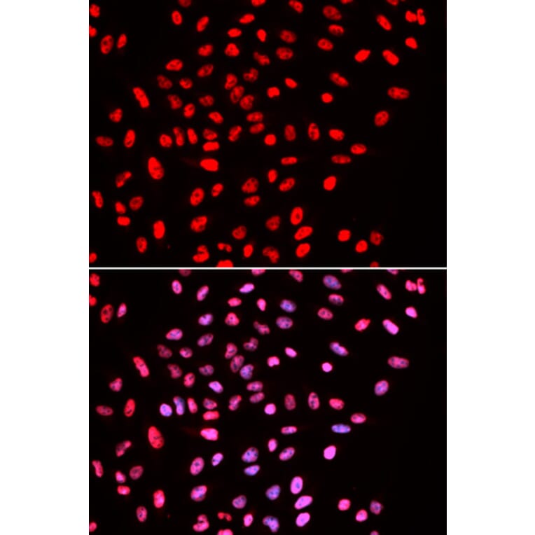 Immunofluorescence - Anti-BAF57 / SMARCE1 Antibody (A14701) - Antibodies.com