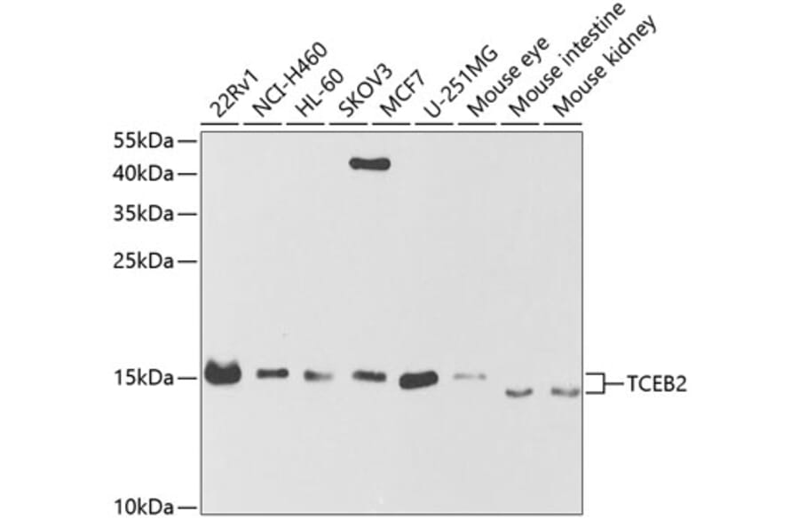 Western Blot - Anti-TCEB2/Elongin-B Antibody (A14702) - Antibodies.com