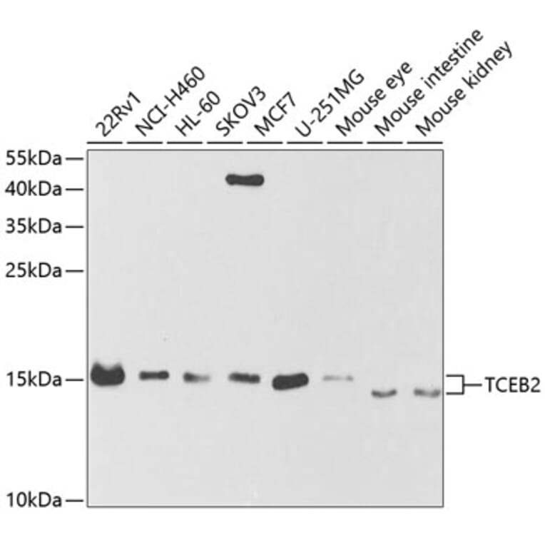 Western Blot - Anti-TCEB2/Elongin-B Antibody (A14702) - Antibodies.com