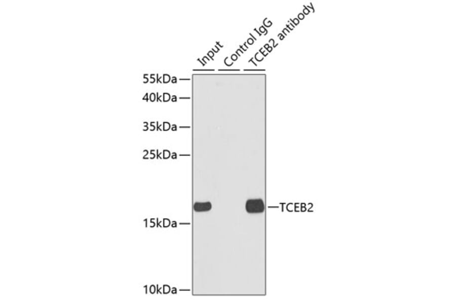 Western Blot - Anti-TCEB2/Elongin-B Antibody (A14702) - Antibodies.com