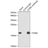 Western Blot - Anti-TCEB2/Elongin-B Antibody (A14702) - Antibodies.com