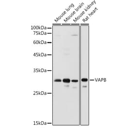 Western Blot - Anti-VAPB Antibody (A14703) - Antibodies.com