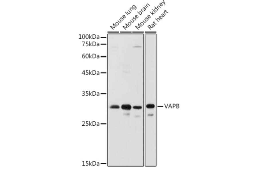 Western Blot - Anti-VAPB Antibody (A14703) - Antibodies.com