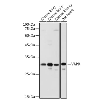 Western Blot - Anti-VAPB Antibody (A14703) - Antibodies.com